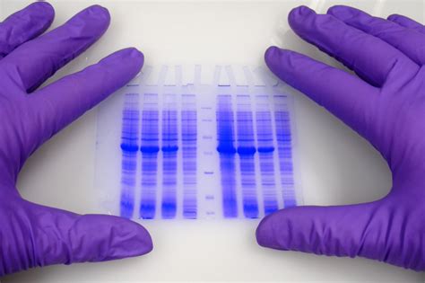 Eletroforese De Proteinas Detecta O Que
