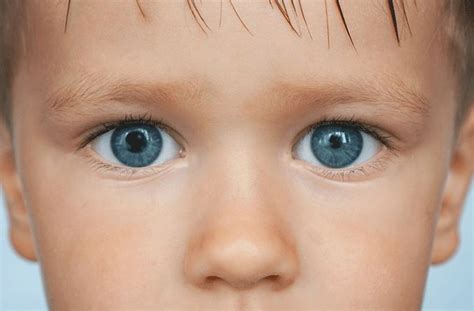 Miosis What Causes Constricted Pupils All About Vision