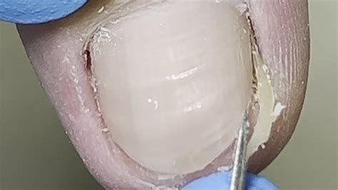 professional pedicure turn toenails into perfect shape【xue yidao pedicure】 youtube