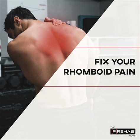 How To Fix Rhomboid Pain P Rehab