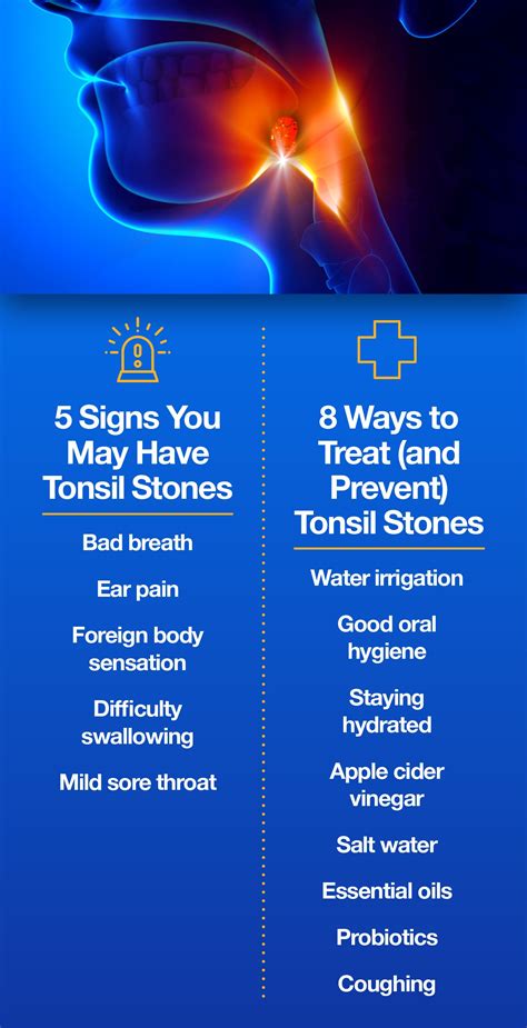 What Causes Tonsil Stones And What Do We Do About It The Amino Company
