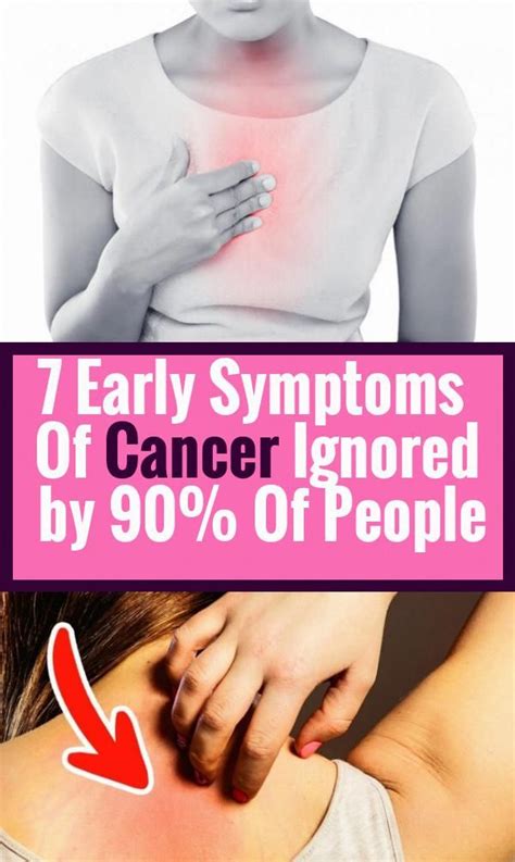 Early Cancer Signs Everyone Ignores In 2020 Cancer Sign Cancer