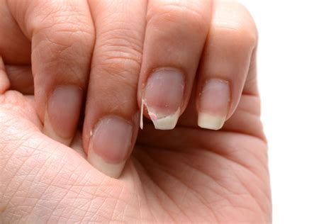 How To Fix A Broken Nail In 5 Minutes Better Homes And Gardens