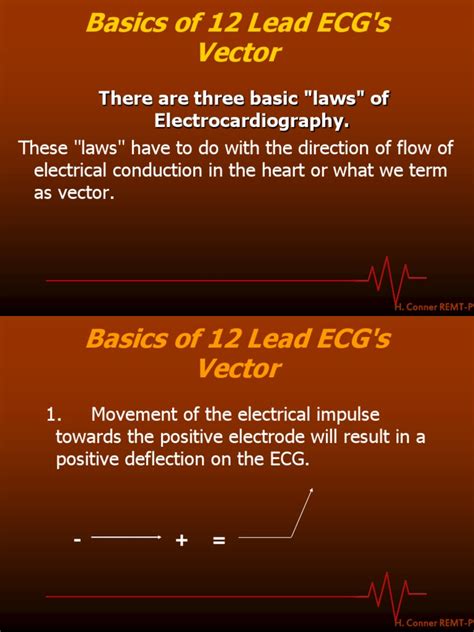 Vector Basics Of 12 Lead Ecg S Electrocardiography Heart