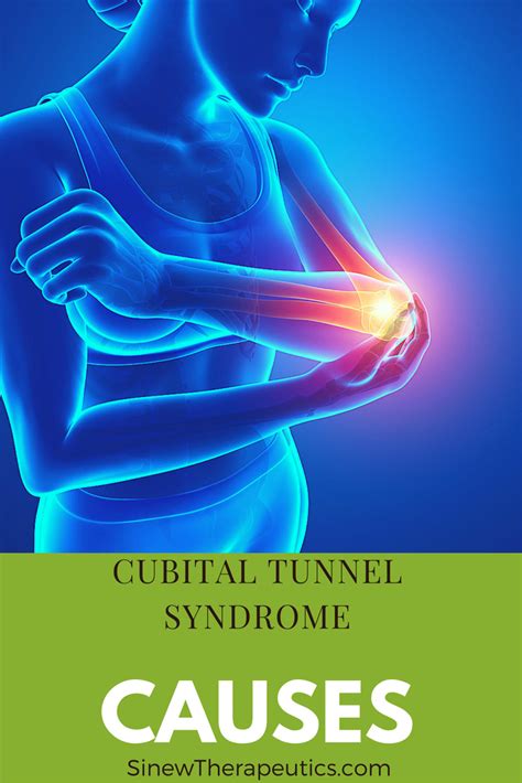 Pin On Cubital Tunnel Syndrome