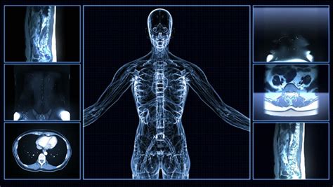 Body Ct Scan Image Radiography X Ray Examination Mri Tomography