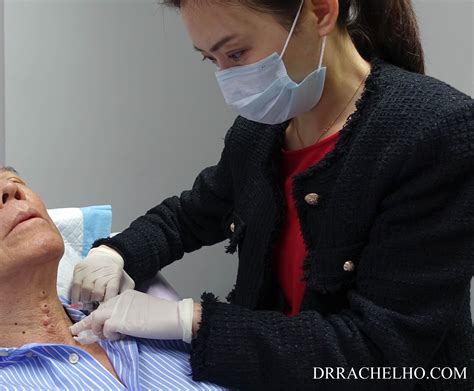 Dr Rachel Ho Neck Profhilo Injection