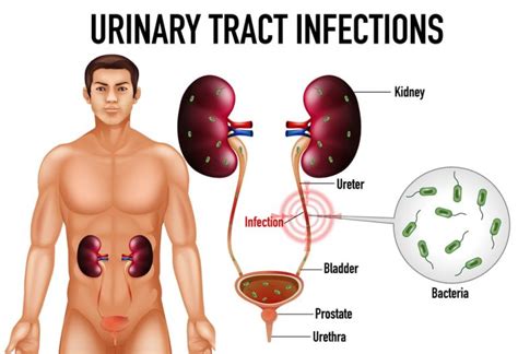 Urinary Tract Infection Uti Treatments And Drugs