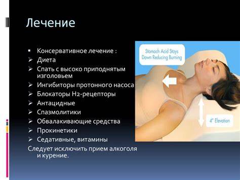 Рефлюкс-эзофагит - презентация онлайн Картинка - Рефлюкс-эзофагит - презентация онлайн