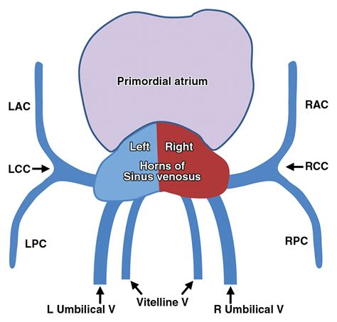 Imaging Of The Coronary Sinus Normal Anatomy And Congenital