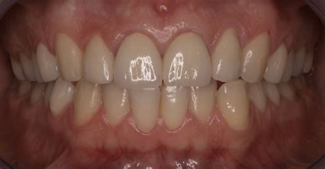 Simple Science: How to Make a Volcano with Kids