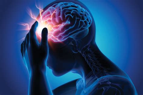 Stroke Brain Attack Types Causes Signs Symptoms Risk Factors