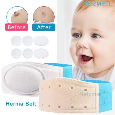 Neizmell 12 Pcs Set Baby Umbilical Hernia Hernia Belt Hernia Therapy