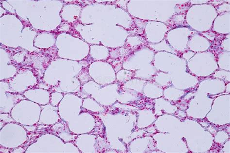 Cross Section Of Human Lung Tissue Showing Bronchiole And Alveoli Stock