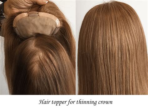 Hair Topper For Thinning Crown Great Weapon To Combat Baldness