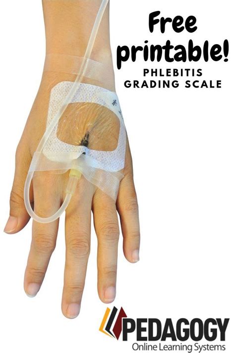 Phlebitis Grading Scale Free Printable Online Learning Continuing