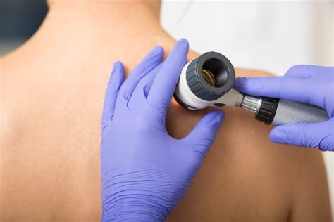 Skin Cancer Checks Reskin Medical