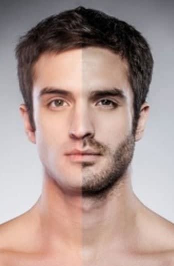 Laser Hair Removal For Men Vs Medspa Laser Hair Removal Clinic