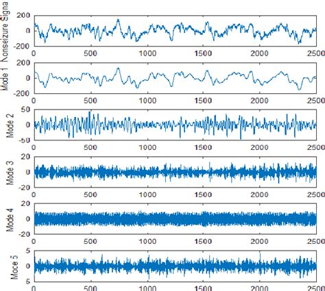 Figure 1 From Detection Of Epileptic Seizure Event In Eeg Signals Using