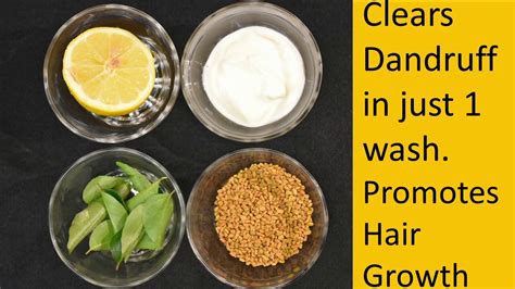 Clears Dandruff In One Wash Dandruff Treatment At Home Home Remedy