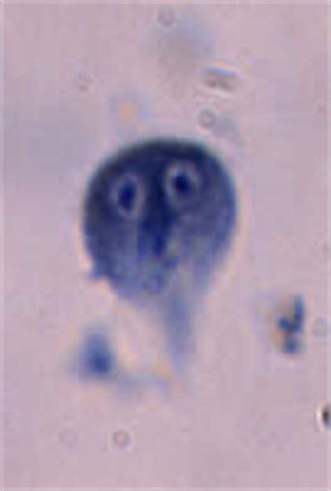 Giardiasis Microscopy Findings