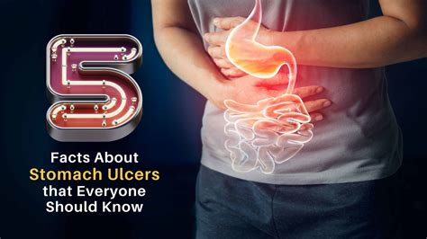 Symptoms And Signs Of Stomach Ulcers