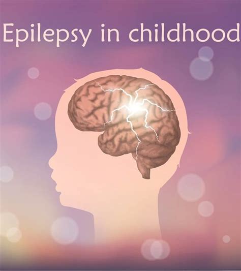 5 Signs Symptoms And Treatment For Epilepsy In Children