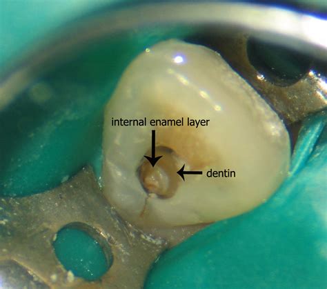 Pin on Dental Education