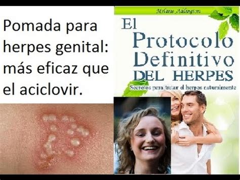 Pomada Para Herpes Genital Elimina El Herpes Para Siempre YouTube
