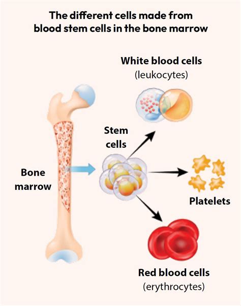 Inherited Bone Marrow Failure Syndromes