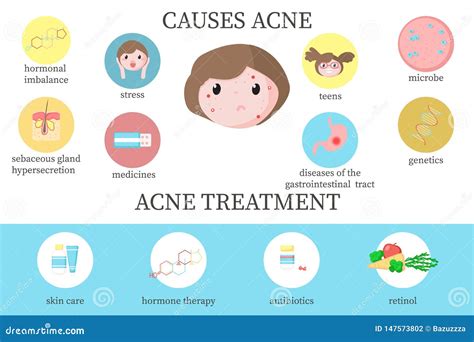 Acne Causes And Treatment Diagram Vector Flat Illustration Stock