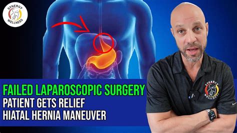 Failed Laparoscopic Surgery Patient Gets Relief From Hiatal Hernia Non