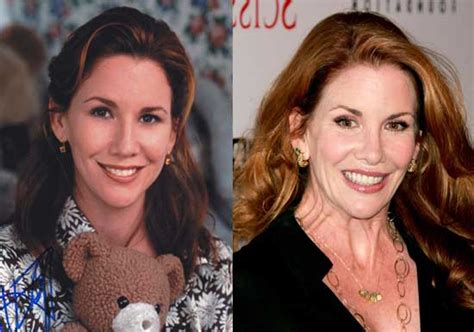 Melissa Gilbert Plastic Surgery Before And After Top Piercings