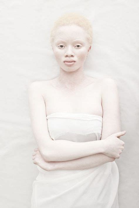 15 Albino Women And Girls With Gorgeous Natural Hair [gallery] With Images Albinism African