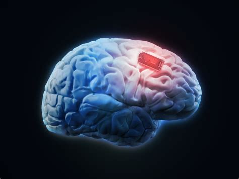 Human Brain Implant Globetrender