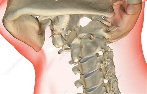 Hey everyone, i thought that. The bones of the neck - Stock Image - F001/8406 - Science Photo Library