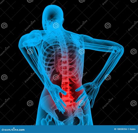 Espina Dorsal Humana En La Opinión De La Radiografía Dolor De Espalda