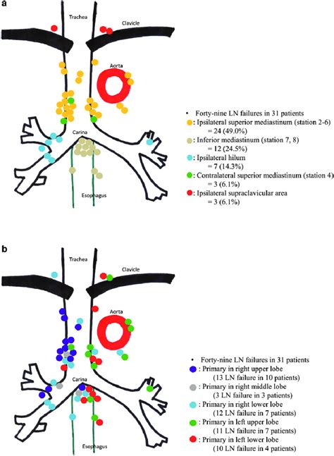 Patterns of regional lymph node (LN) oligo-recurrence after initial... | Download Scientific Diagram