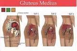 Pictures of Gluteus Medius Strain Recovery Time