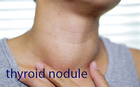 Thyroid Nodule The Causes Diagnosis And Treatment Options Tambaram