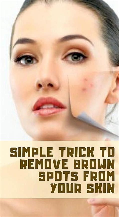 Pin On Get Rid Of Brown Spots On Face