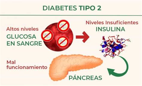 Diabetes tipo 2 Qué es Causas Síntomas y Tratamiento Natural