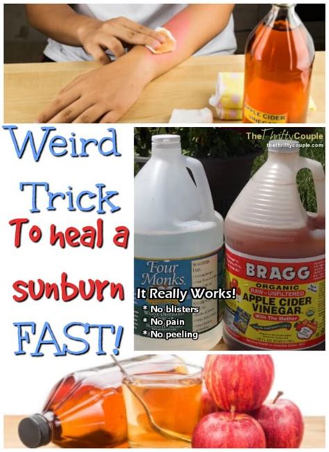 Do this immediately and keep the area around the burn clean and clear. How to Heal A Sunburn (No blisters, No Pain and No peeling ...