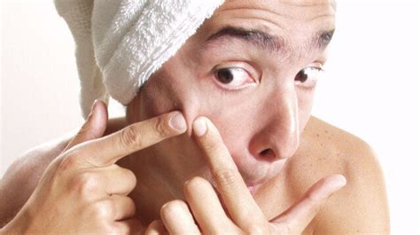 pimple popping acne blisters and scabs 9 things you shouldn t pop huffpost life