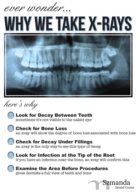 How To Do Teeth X Ray Ababyw