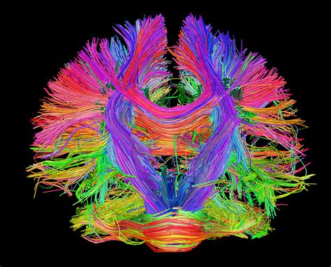 Mapping the Human Brain to Understand the Human Mind — THE THINK TANK