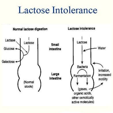 This is the direct cause of uncomfortable symptoms such as foamy diarrhea, abdominal cramps, and flatulence. LACTOSE INTOLERANCE - I am part of Biochemistry family :)