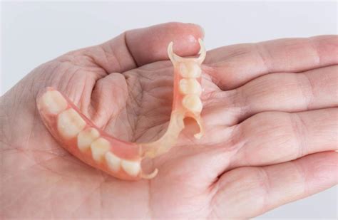 Types Of Partial Dentures How Do You Choose European Denture Center 2022