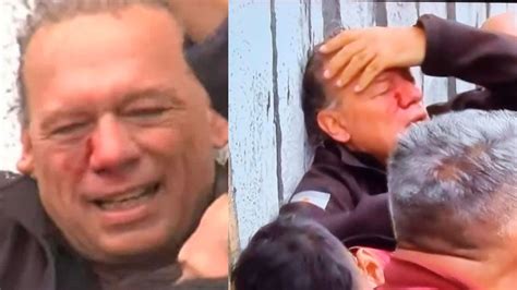 Sergio Berni Fue Agredido A Golpes Y Pedradas En El Corte De Colectiveros En La General Paz