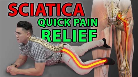 If one doesn't control their blood sugar levels over a period of many years, nerves and blood vessels. One Minute Sciatica Exercise to Cure Sciatica & Quick Pain ...